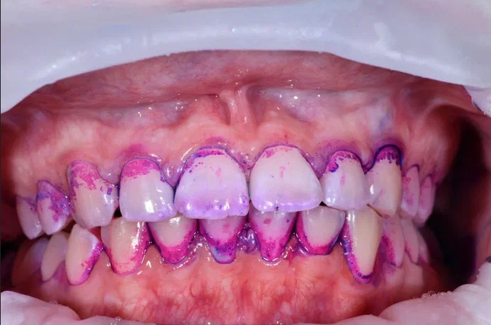 Before image