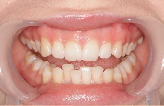 Before image