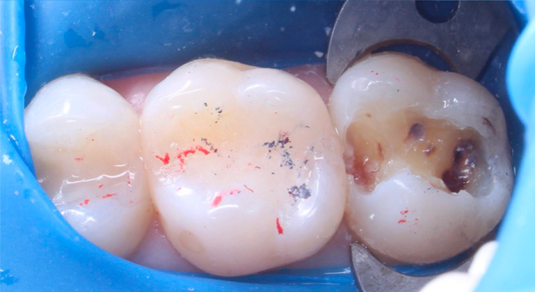 Before image