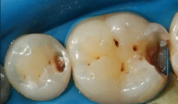 Before image