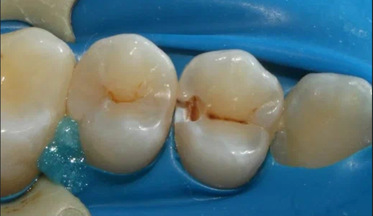 Before image