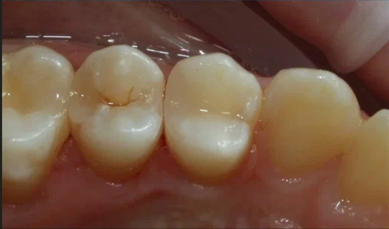 After image
