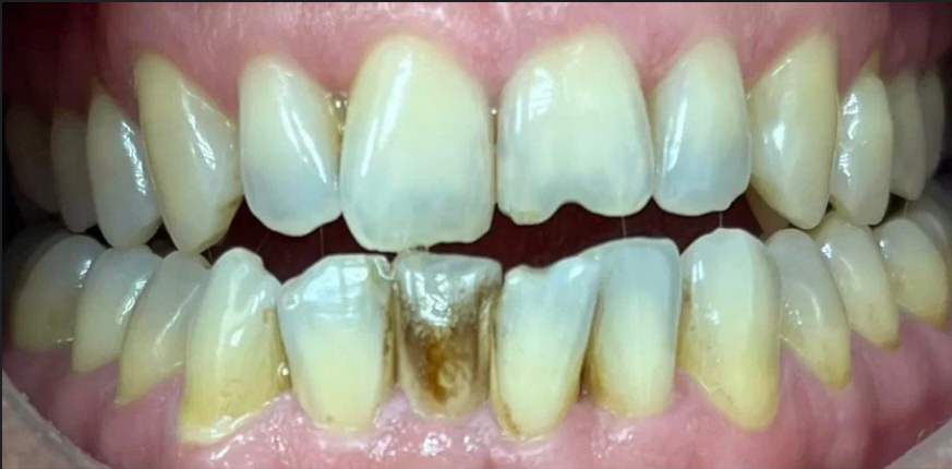 Before image