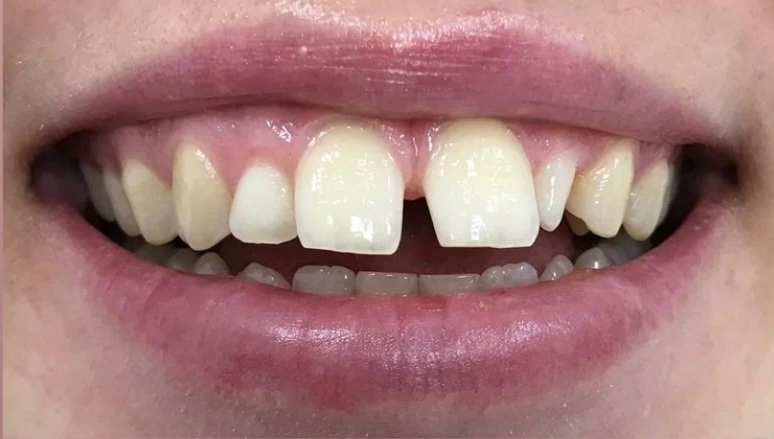 Before image