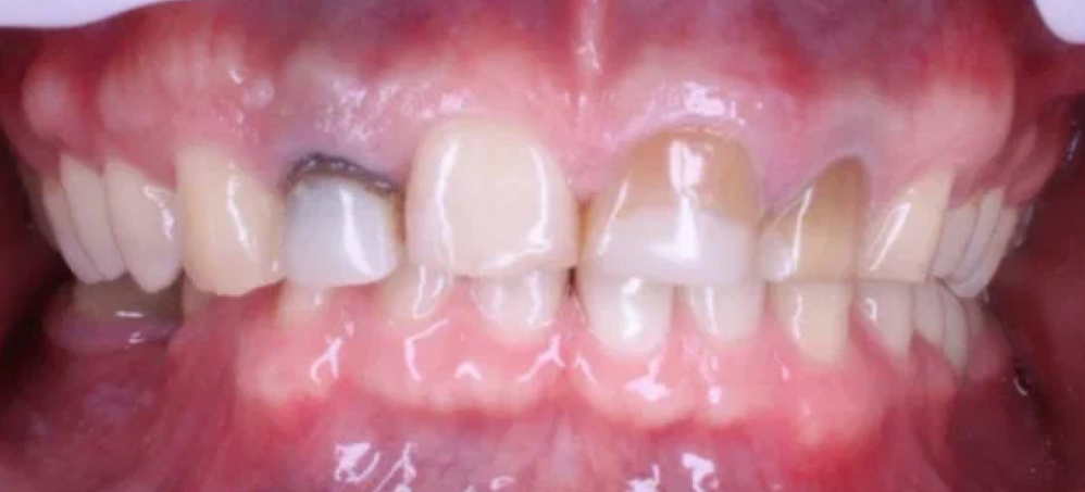 Before image