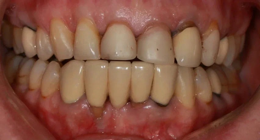 Before image